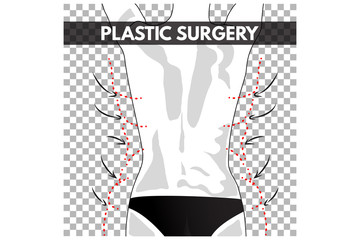 Rear Plastic Surgery. Vector Illustration.