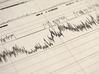 Fototapeta premium polysomnography (PSG) sleep study