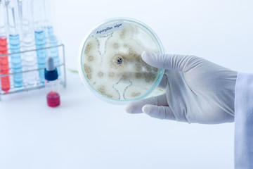 Scientist show colony of fungus (Asperillus niger) in culture medium plate