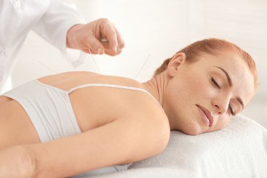 Therapy of female body with pricking acupuncture needles