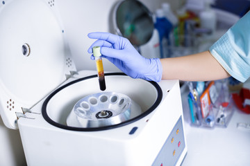 Plasmolifting. Preparation of blood for injections. cosmetologist puts tube of blood in centrifuge