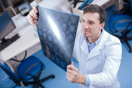 Handsome Professional Oncologist Looking At The Brain X Ray Images