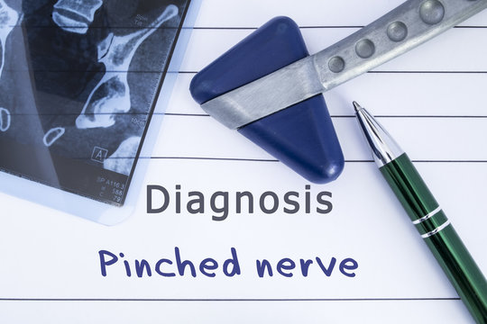 Diagnosis of Pinched Nerve. Medical health history written with diagnosis of Pinched Nerve, MRI image sacral spine and neurological hammer. Medical concept for Neurology, Neuroscience