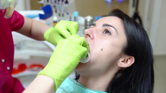 Closeup view of the dentist's hands putting rubber dam in a mouth of a female patient. Shot in 4k
