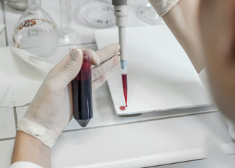 Medical laboratory scientists in the laboratory filling test tubes with pipette