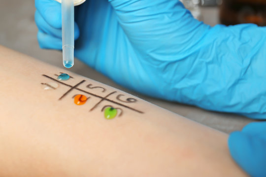Doctor making allergy test in laboratory