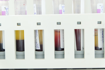 test tube cbc lab