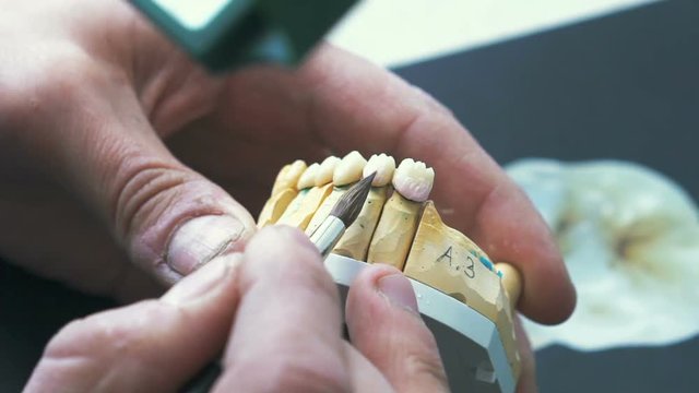 Dental technician applying ceramics glaze to a cast made with CNC dental machine