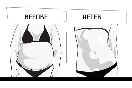 Obesity crisis. Before and after. Vector Illustration. Overweight woman.
