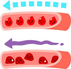 血液の流れ　サラサラ、ドロドロ