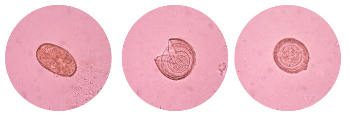 eggs parasite