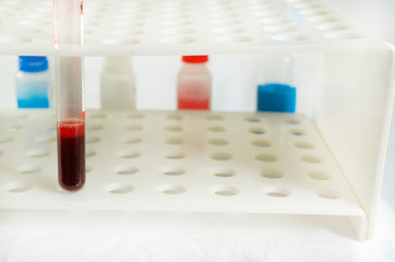 Blood sampling and analysis in a biochemical laboratory on a light background.