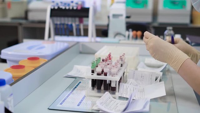 Crop hands of specialist checking specimen. Crop hands of laboratory worker checking specimen with blood on blurred background.