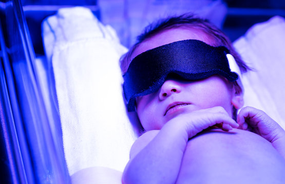 Newborn Baby Receiving Phototherapy For Jaundice