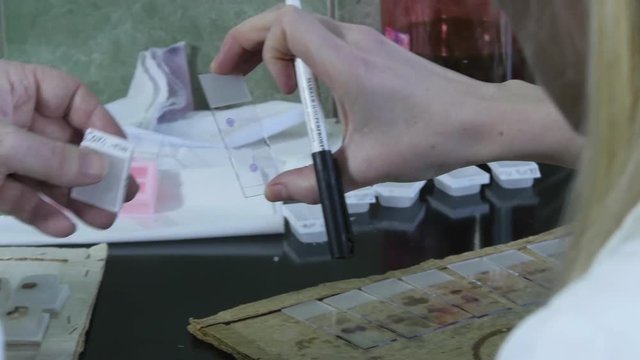 Hands of mature male and younger female laboratory technicians analyzing a tissue samples separated on the plates and writing diagnosis, close up, concept pathology  analysis, interior scene.