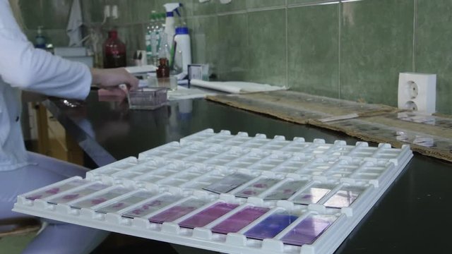 A tissue samples on the glass plates in focus, close up, hands of female technicians performing laboratory analysis,  concept pathology test,  interior scene