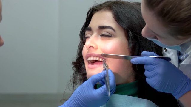 Dentists installing teeth braces. Doctor holding a spatula. Types of dental brackets.
