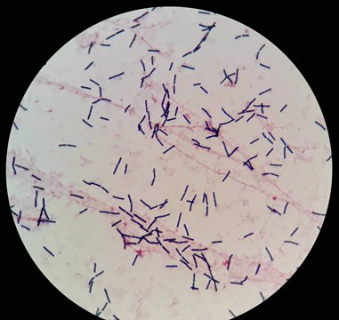 Smear of human blood culture Gram's stained with gram positive bacilli bacteria, under 100X light microscope.