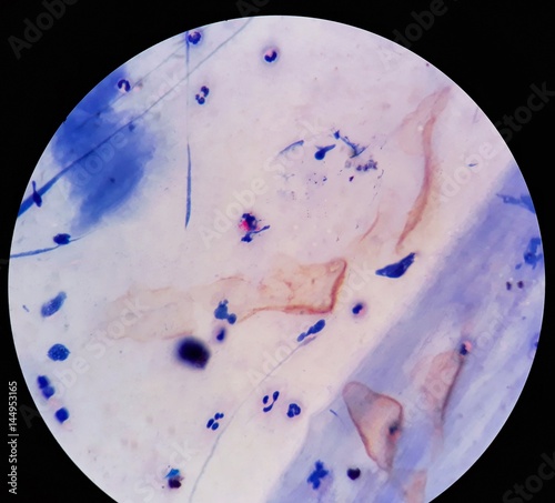 smear-of-acid-fast-bacilli-afb-stained-from-sputum-specimen-with