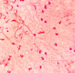 Smear of sputum specimen Gram's stained under 100X light microscope.