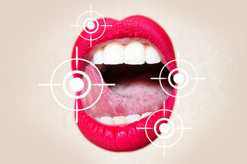 Infection on the lips. Sexy mouth with pink lipstick, white teeth, seductive tongue, open lips. Lips icon. Cosmetics for women's lips. Herpes virus. Immunity, spring problems on the mouth