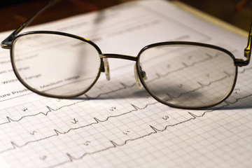 Electrocardiogram Readout