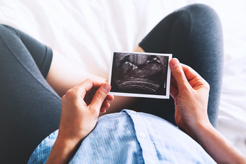 Pregnant woman holding ultrasound image