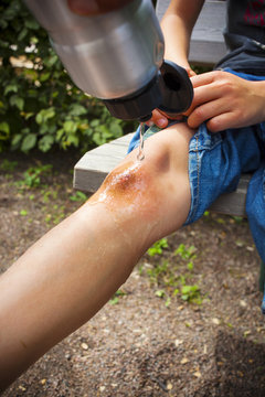 Water being poured on schoolboy's wounded knee at playground