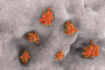 Entamoeba histolytica protozoan invading intestine. Parasite which causes amoebic dysentery and ulcers. 3D illustration