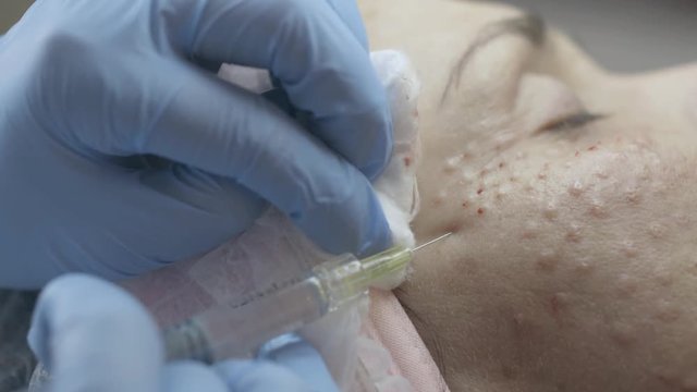 Close-up of the cosmetologist doing botox injections for the client in the beauty salon,  slow motion
