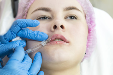 The process of cosmetic surgery of water injection in the area of the lips of a woman 