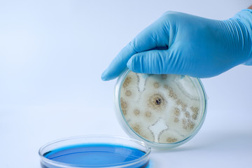 Scientist show colony of fungus in culture medium plate