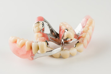 Clasp prosthesis with lock fixation