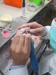 Lo stampo di lucidatura del laboratorio odontoiatrico dentale