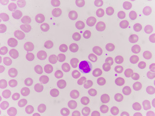 Normochromic normacytic red blood cells