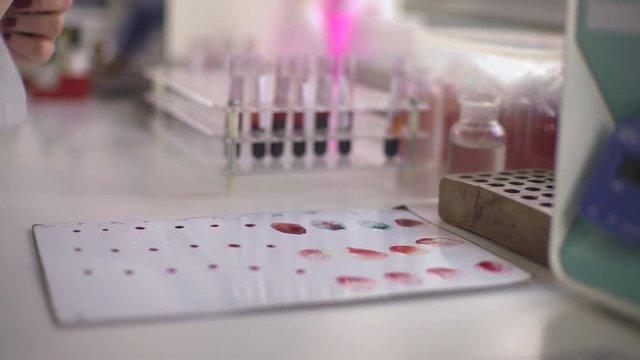 Hands close up of laboratory technician while using pipette to determinates blood types on the white plate, shallow depth of field, dolly shot