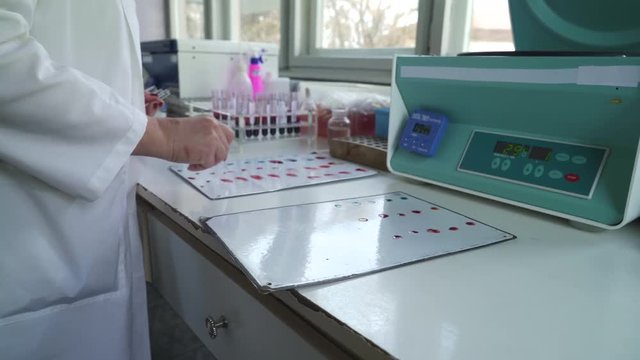 Laboratory technicians using chemicals to determinate blood types, she mixing fluids on the white plates, hands close up, dolly shot, shallow depth of field.