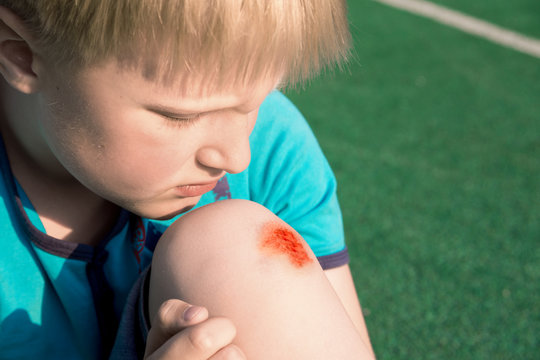 Boy With A Scraped Knee