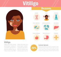 Vitiligo. Pigmentation disorder