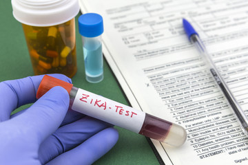 Scientist with blue latex gloves holds vials of ZIKA virus in laboratory for analysis