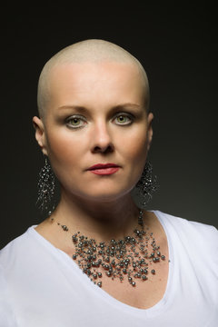 beautiful middle age woman cancer patient without hair