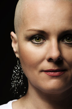 beautiful middle age woman cancer patient without hair