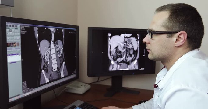 4K The tired young doctor looks at the monitors with CT shots.