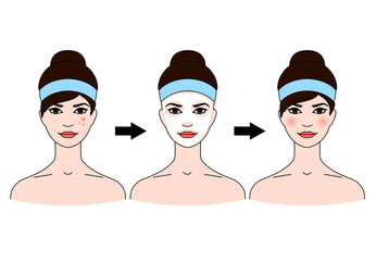 Step-by-step use of facial masks from acne.