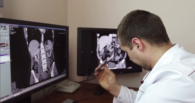 4K The tired doctor took off his glasses while sitting at the monitors with an X-ray examination.
