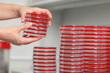 Many cups of petra are on the table in a medical laboratory, close-up
