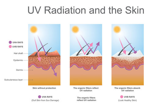 UV radiation and the skin.
Effects the elastin in the skin and leads to wrinkles. Vector graphic, Illustration.