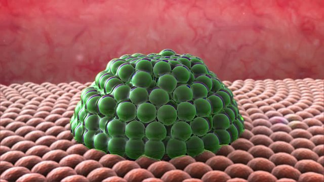 3d rendered cancer cell, Clusters of cells, group of Cancer cell, Macrophage attack of the cells, Proliferation of cancer cell