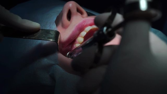 Maxillofacial Surgery, anesthesia
