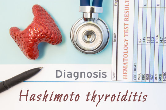 Endocrinology diagnosis Hashimoto's Thyroiditis. Figure of thyroid gland, result of laboratory blood analysis, medical stethoscope lying near text inscriptions Hashimoto Thyroiditis doctor workplace 